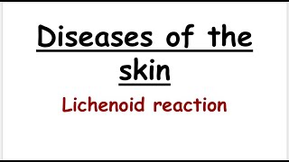 lichenoid reaction [upl. by Turk623]