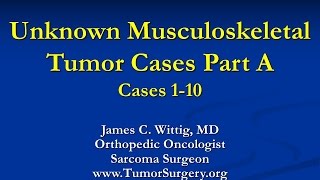 Orthopedic Oncology Course  Unknown Test Cases Part A Cases 110  Lecture 11 [upl. by Hakaber]