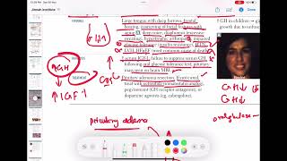 Acromegaly endocrinology 37  First Aid USMLE Step 1 in UrduHindi [upl. by Toby]