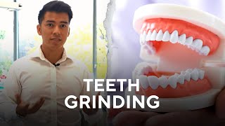 What to do about Teeth Grinding [upl. by Angel298]