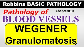 Ch10  WEGENER GRANULOMATOSIS  Blood Vessel Pathology  Robbins Lectures [upl. by Yael]