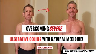 Reversing 17 Years of Severe Ulcerative Colitis with Natural Medicine [upl. by Verla176]