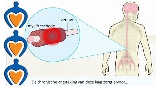 Multiple Sclerose MS  Wat is het en wat zijn de symptomen [upl. by Enelec]