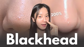 How to really remove blackheads at home in 7 days No matter your skin type [upl. by Asiluy]