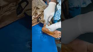 INTRAARTICULAR INJECTION FOR ANKLE PAIN [upl. by Akihsar375]