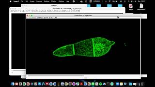 How to process a zstack image into a 2D image in ImageJ  How to process confocal microscope images [upl. by Anaidiriv]