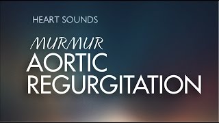 Aortic InsufficiencyRegurgitation murmur  With Murmur Sounds Audio [upl. by Eimmis799]