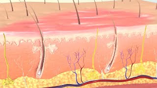 How Burns are Classified and Treated [upl. by Dorthy]