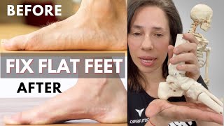 Flat Feet and the Effects on Posture  HOW TO FIX IT 2021 [upl. by Onder]