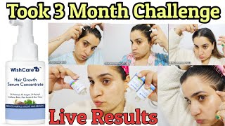 Wishcare Hair Growth Serum Review  3 Month Experience ⛔ Non Sponsored ⛔ [upl. by Tami]