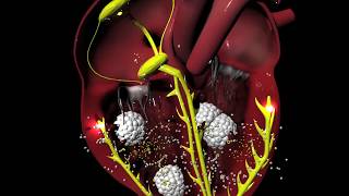 Digoxin for Arrhythmias irregular heartbeat [upl. by Anilra]