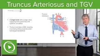 Truncus Arteriosus and TGV Pathology – Pediatric Cardiology  Lecturio [upl. by Htevi]