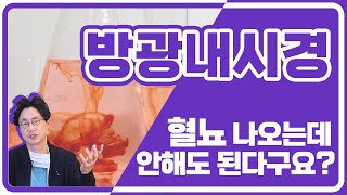 슬기로운방광tv quot방광 내시경quot 이런 경우 꼭 할 필요 없다 [upl. by Ased224]