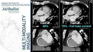 Cardiac CT Current Technology amp Principles Faisal Nabi MD FACC September 11 2018 [upl. by Analos]