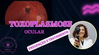 Toxoplasmose ocular  Como é o tratamento e como se prevenir [upl. by Eahsel918]