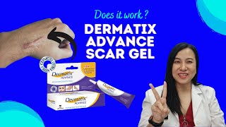 How To Reduce Scars with Dermatix Advanced Scar Gel [upl. by Asante646]