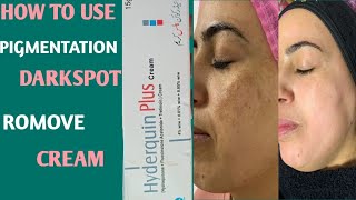 Hyderquin Plus cream 🙂Benefits amp side Effects 🙂Full Reviw With HIJAB 🙂 [upl. by Esekram]