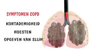 Onderdeel 1 Wat is COPD [upl. by Ellehcsar221]