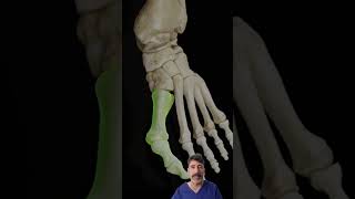 ¿Que es un JUANETE o HALLUX VALGUS dolor fisiolution juanetes dolorpies [upl. by Tannie311]