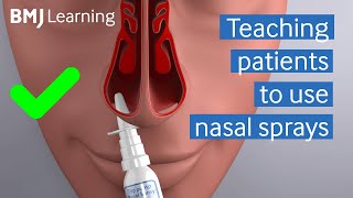 How to Use Childrens Flonase Nasal Spray Young Children [upl. by Ezri]