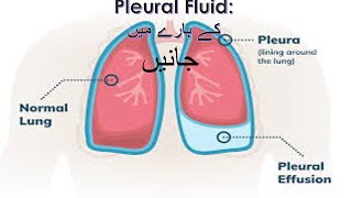 Pleural Fluid جانیں اس کے بارے میں [upl. by Aieka]