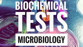 Biochemical TestsPart 1 [upl. by Pax]