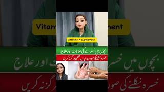 Bacho me Khasra ki Bimari ka ilaj  Measles treatment in urdu measles treatment vaccination [upl. by Waverley]