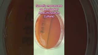 Serratia marcescens growth on Macconkey agar [upl. by Astrahan]