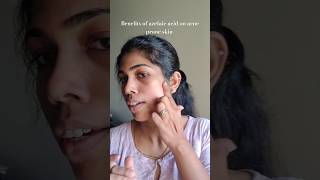 The ordinary azelaic acid review beeglam tamil youtubeshorts shortvideo manasilaayo [upl. by Sesilu]