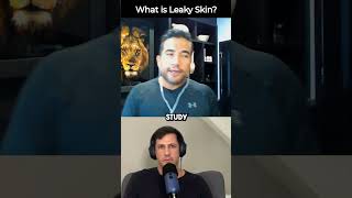 WHAT IS LEAKY SKIN Leaky Gut  Skin Problems Best Topical Probiotics for Acne amp Rashes Explained [upl. by Leanard188]