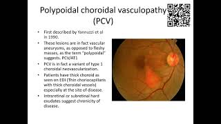 Pachychoroid disease part 2 [upl. by Sachs]