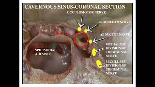 Sphenoid Bone [upl. by Screens]