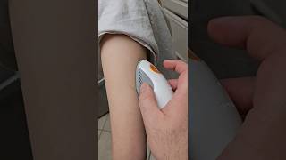 First Dexcom change of the year diabetes t1d typeonediabetes dexcom dexcomg6 expressionmed [upl. by Llenrahc]