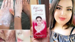 Fair amp Lovely Cream में ये चीज मिलाकर लगालो 10 मिनट सारे काले दाग धब्बे निशान हटाकर चेहरा गोरा [upl. by Ahsyekal]