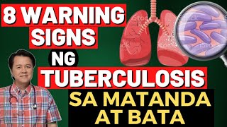 14 Sakit ng Bata Hand Food Mouth Disease atbp By Doc Willie Ong [upl. by Herodias561]