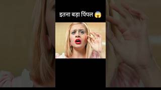 इतना बड़ा पिंपल 😱 l horror movie explained in HindiUrdu shorts [upl. by Platt]