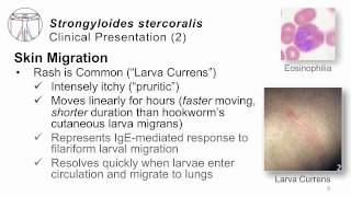 Helminths Strongyloides [upl. by Berthold]