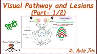 Visual Pathway and Lesions Part12 in Hindi  Visual field defects Anatomy Simplified [upl. by Alleram530]