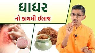 ધાધર માટેની આયુર્વેદ મેડિકલ પરથી આ દવા લઇ આવો  ફરી ક્યારેય ધાધર નહિ થાય  dhadhar no ilaj namdevji [upl. by Henn]