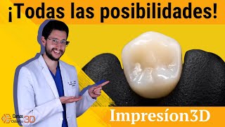 💡 ¿Qué se puede hacer con una impresora 3D en odontología 😎 [upl. by Nylarac915]