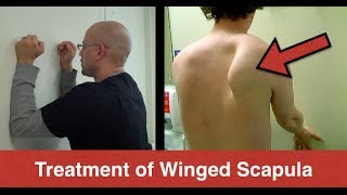 BEST Winged Scapula Exercises Fix Scapular Winging Treatment  Serratus Anterior Exercises [upl. by Atcele221]