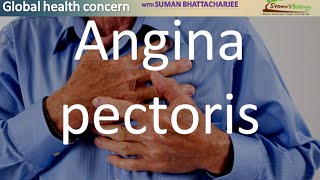 Angina pectoris [upl. by Aerdnuahs]