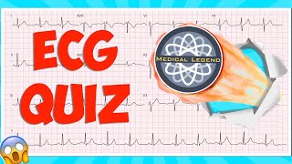 Are You A Medical Legend Test Your Knowledge With This Ecgekg Quiz electrocardiogram [upl. by Lahtnero]