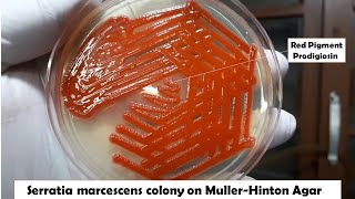 Beautiful colony of bacteria Serratia marcescens [upl. by Berg]