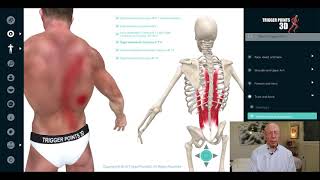 Longissimus Thoracis  Trigger Point of the week [upl. by Ano]