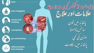 colon cancer symptoms  large intestine cancer symptoms in urdu  badi aant ke cancer ka ilaj [upl. by Nalyac]