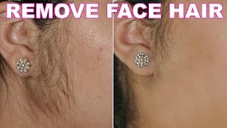 How To Remove Facial Hair Naturally  SkinCare Home Remedy  ShrutiArjunAnand [upl. by Alywt]