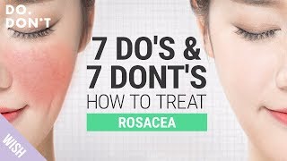 14 Tips for Rosacea That Really Work  Effective Skin Care Tips for Rosacea  Do amp Dont [upl. by Tomasine338]