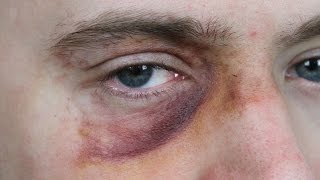 Black Eye Makeup SFX Beginners Tutorial [upl. by Andrus897]