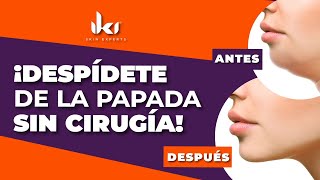 Eliminar la papada sin cirugía es posible estos son 2 tratamientos para lograrlo [upl. by Jary944]